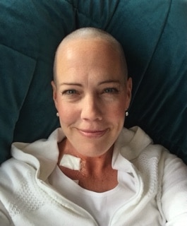 Image of Mer Monson, smiling, reclining, and bald due to cancer treatment.