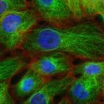 Green and blue cancer cells